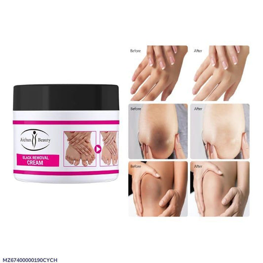 Knee Whitening Cream         / for all body types