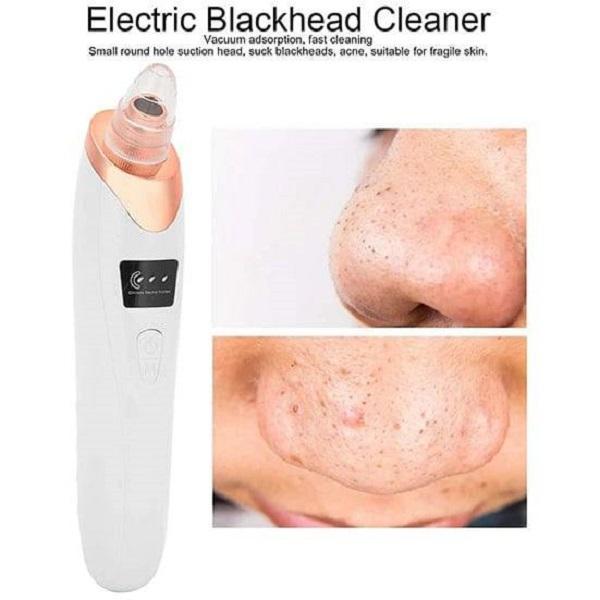 Blackheads , Acne Remover Machine